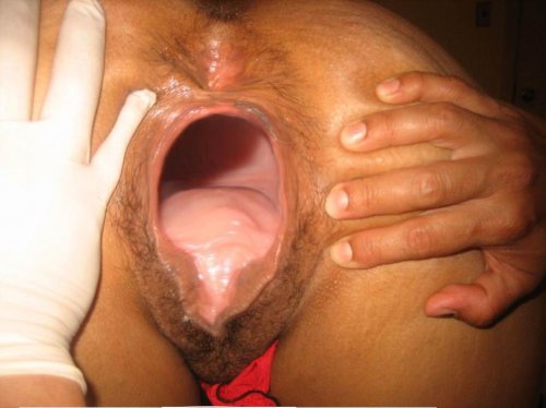 Самая большая вагина в мире фото